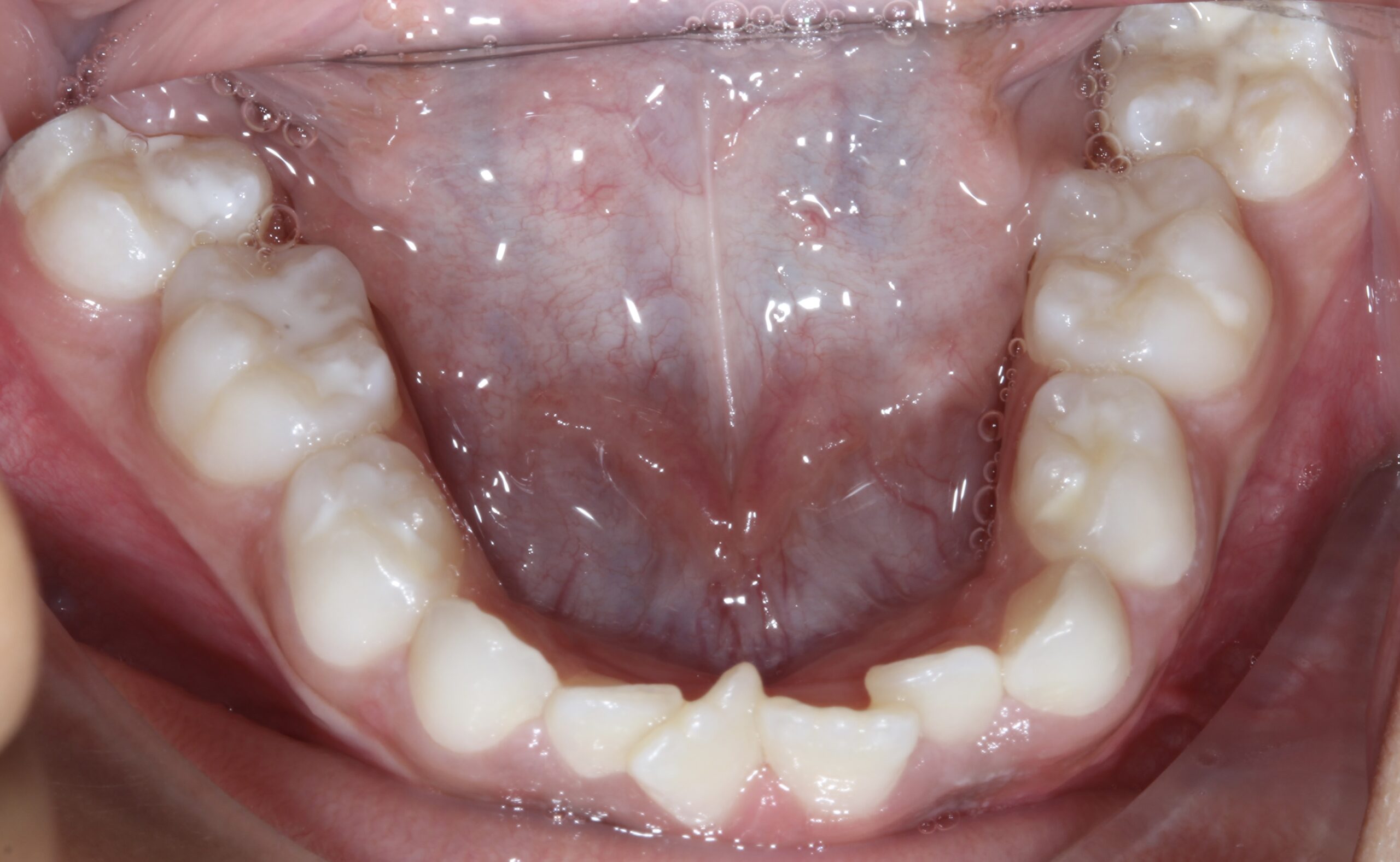 Dentofacial Orthopaedics
