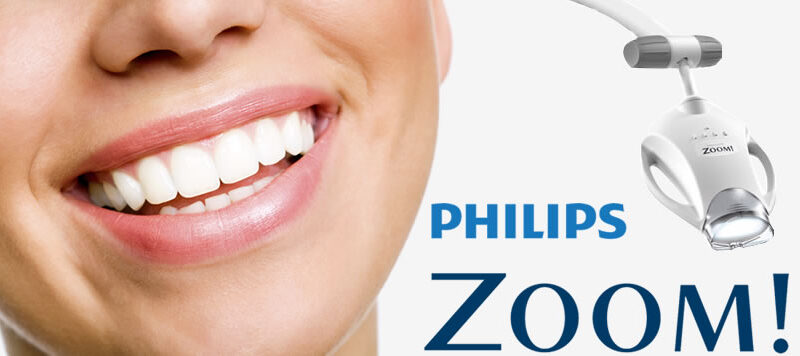 Zoom Whitening