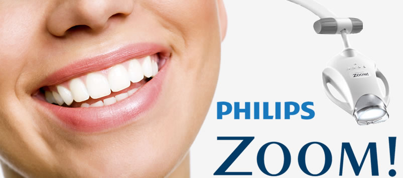 In-Office Zoom Whitening