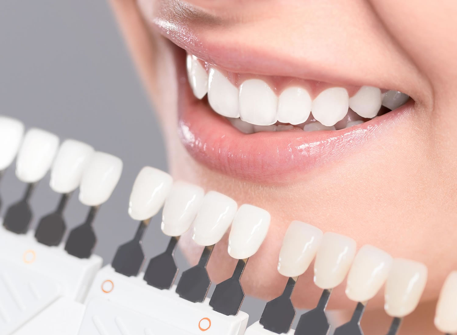 dental services