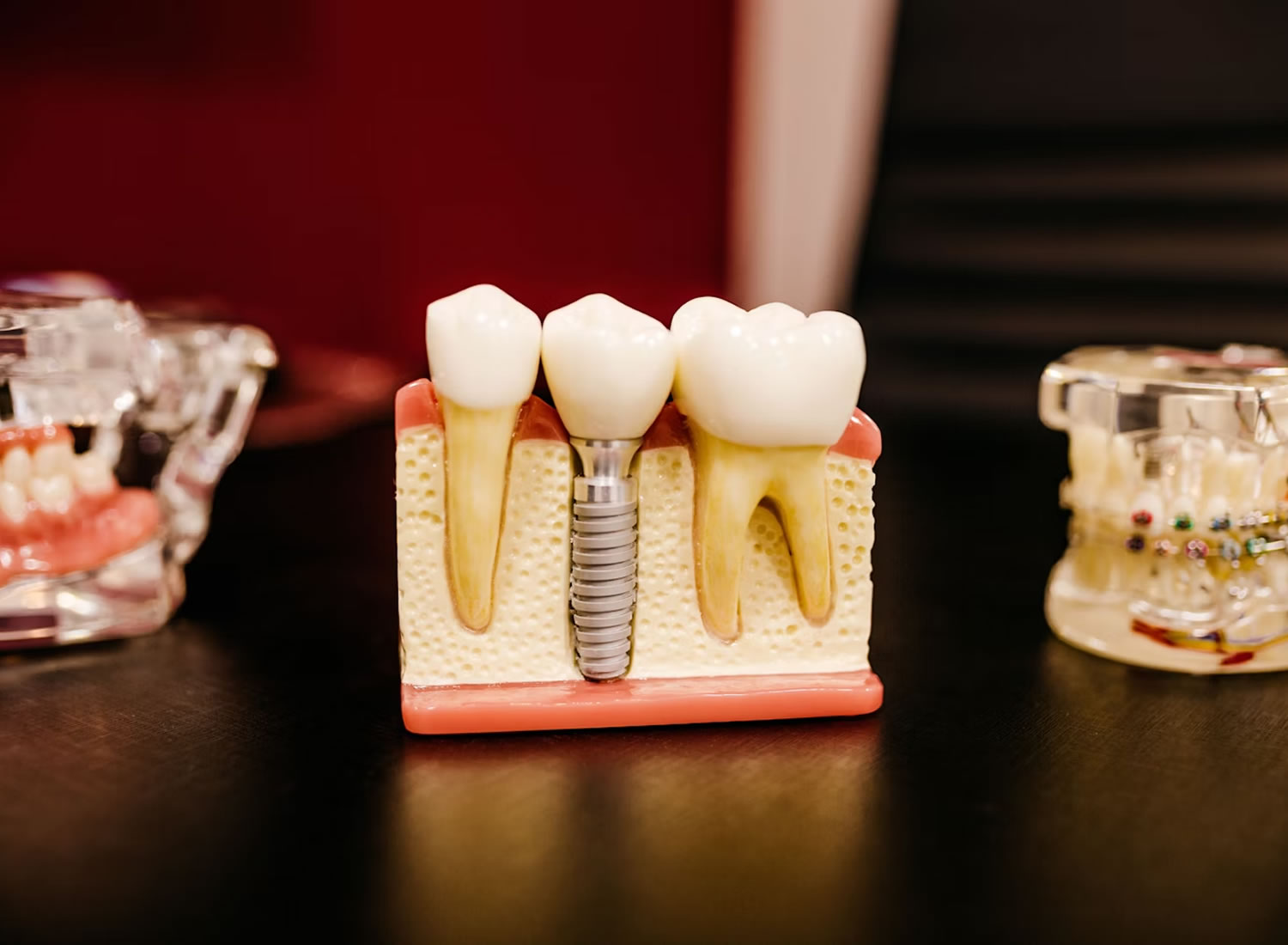 dental services