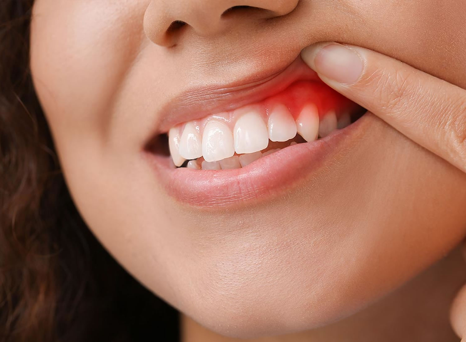 Gums
