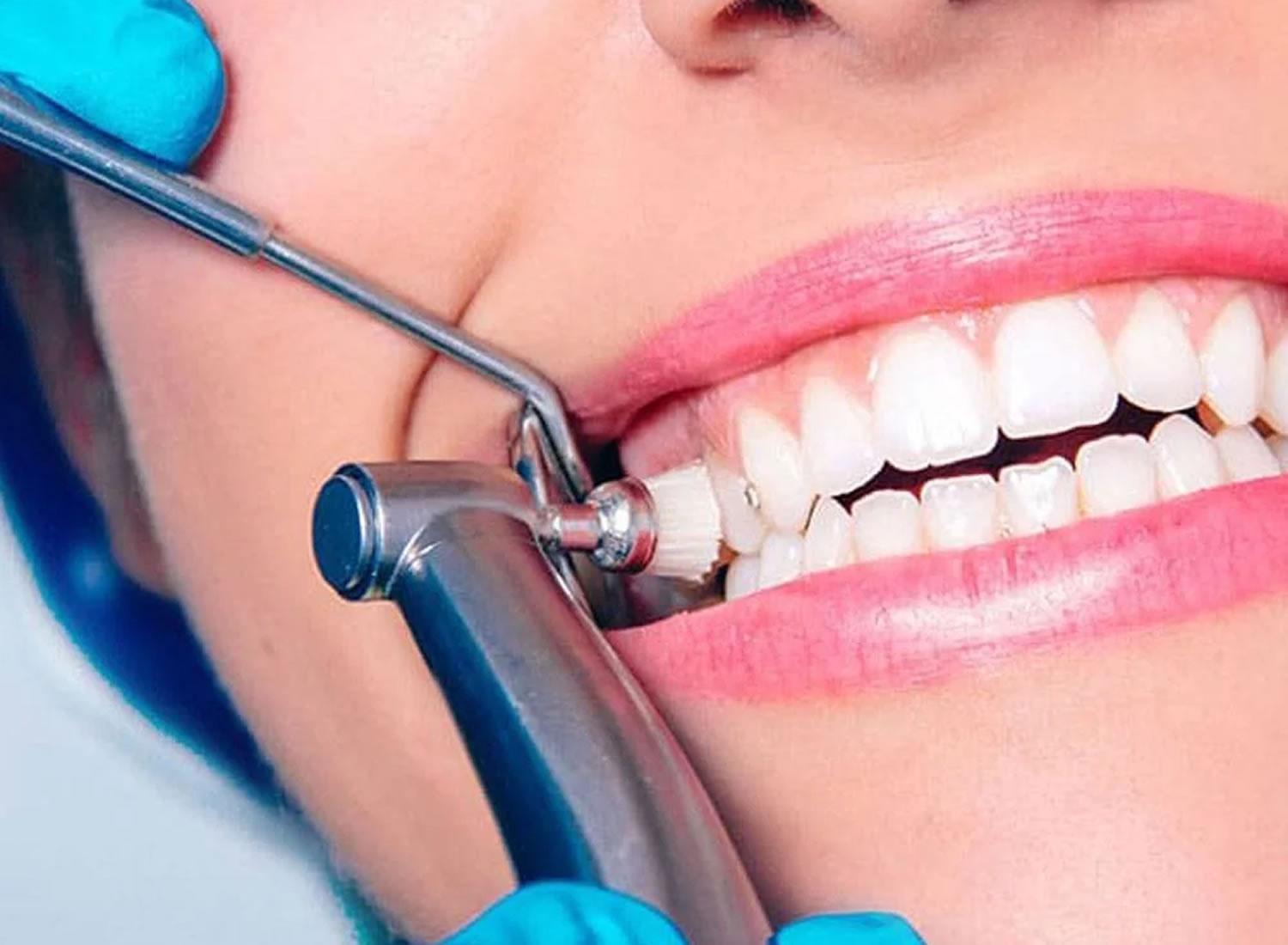 dental services