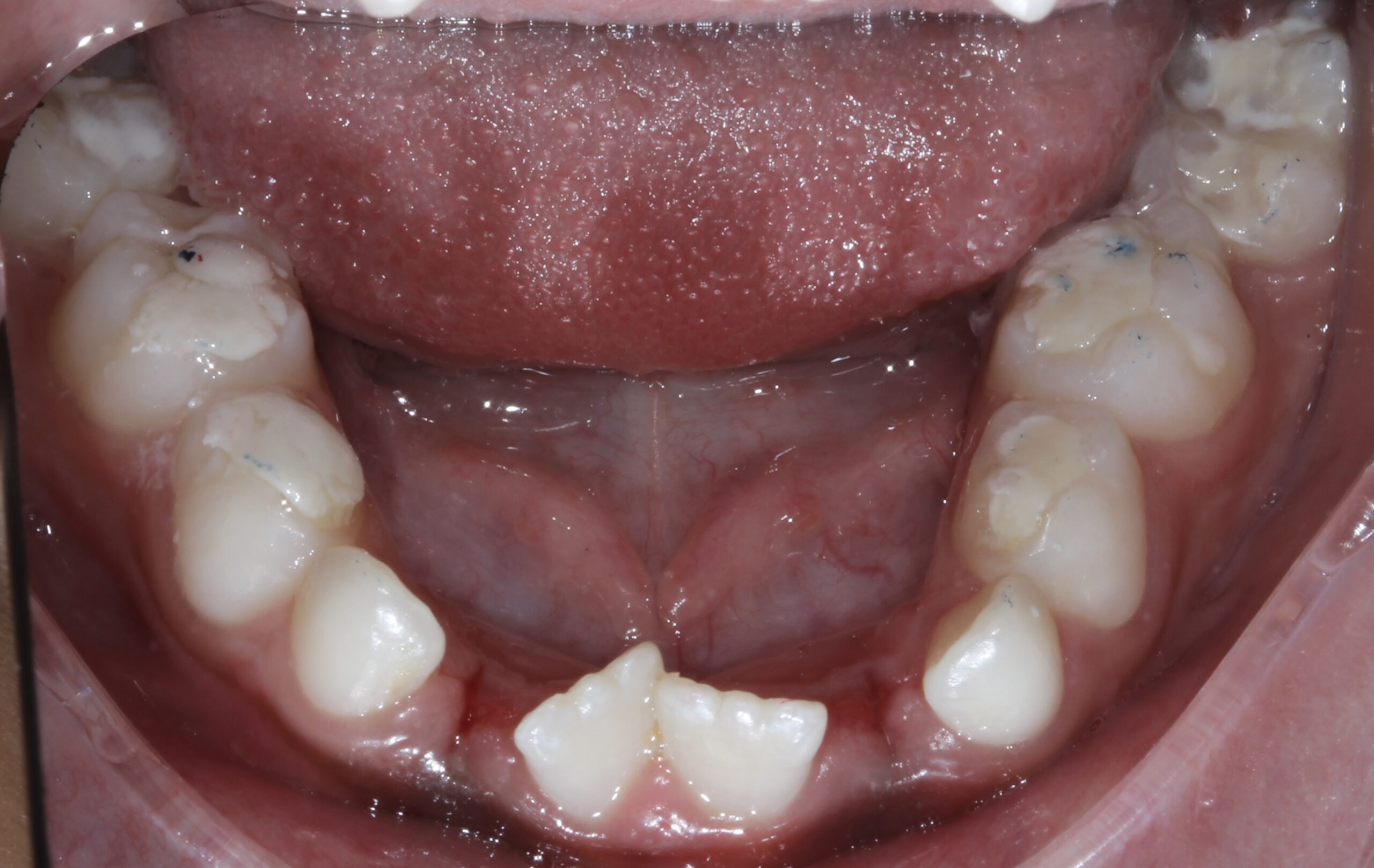 Dentofacial Orthopaedics